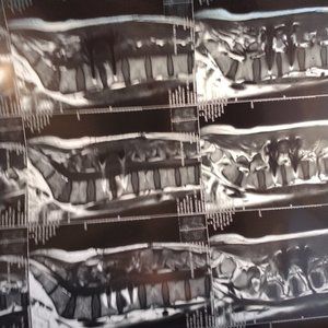 X Ray Film Exposed, Human X Ray MRI Film